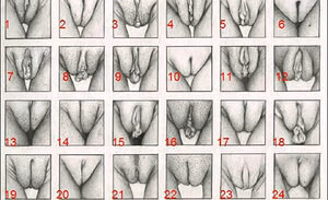 Whitedovecries #4911063